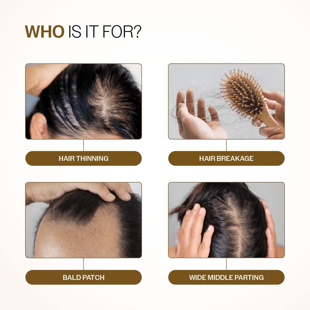 Bare Anatomy Advanced Hair Growth Serum NATURAL HAIR GROWTH INGREDIENTS: Blended with the clinical formulation are 3 natural hair growth ingredients: Rosemary, Biotin & Rice extract that strengthen weak hair, prevents breakage and reduces dryness thereby ensuring healthy hair growth.