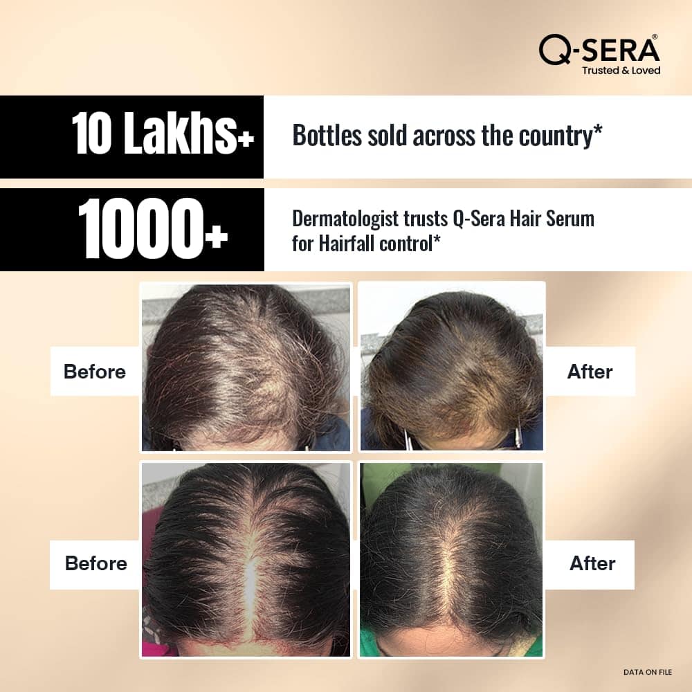 The fast-absorbing formula doesn’t leave a sticky or oily residue, making it comfortable for daily use—even in humid weather.- QSERA Hair Growth Serum